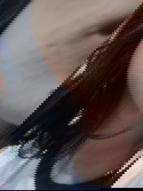 Wajah beruntusan merah