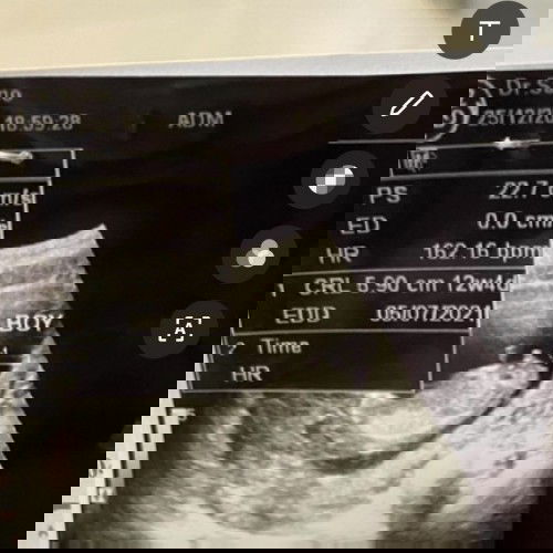 แม่ๆช่วยตอบหน่อยนะคะ