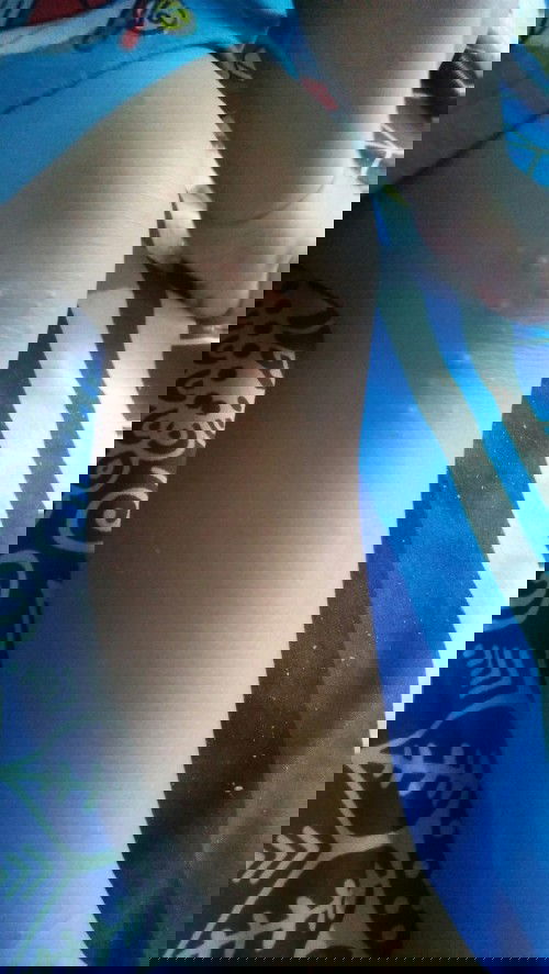 bintik merah pada kaki