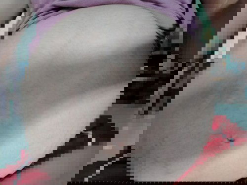 รู้สึกเจ็บบนเนินท้อง