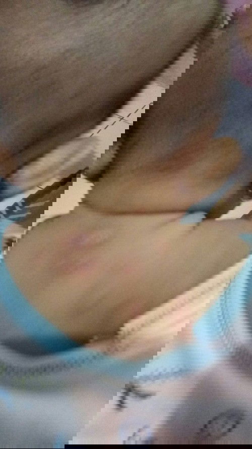 Kulit bayi usia 3bulan