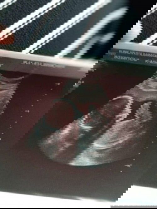 Dah buat Detail Scan?