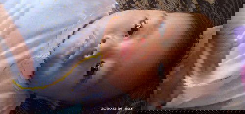 Bagian bawah bibir putih