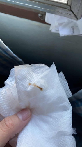 ตกขาวรึเปล่าไม่แน่ใจเลยค่ะ เป็นเมือกสีน้ำตาลขุ่นๆ