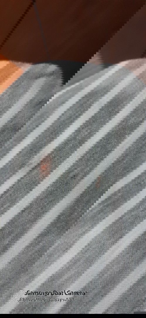 Pregnant  33 weeks now