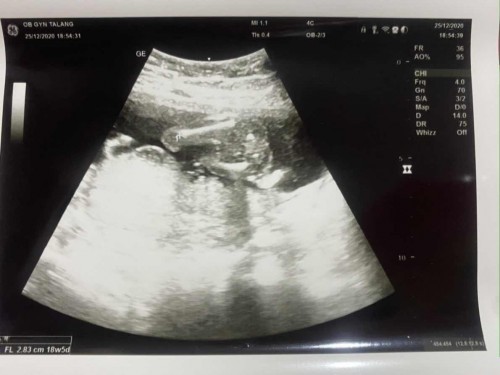 #เจ้าตัวน้อยของแม่