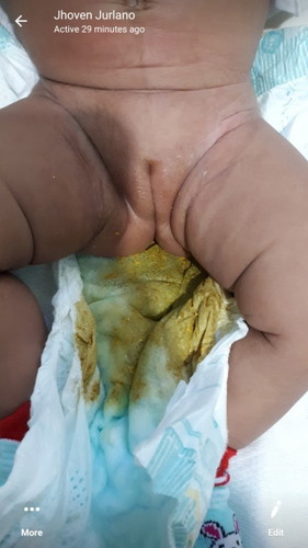 Nagbago ang poopoo ni baby