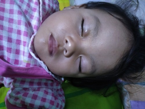 Mata digigit serangga
