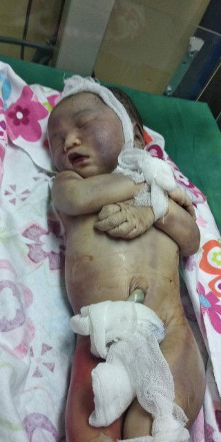 Saya masih sering menangis mengenang anakku tlah berpulang kerumah ALLAH SWT