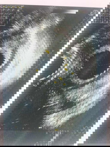 รู้สึกเสียใจมากๆค่ะ ครบ10สัปดาห์ ไม่เจอตัวเด็กค่ะ หมอแจ้งว่าท้องลม