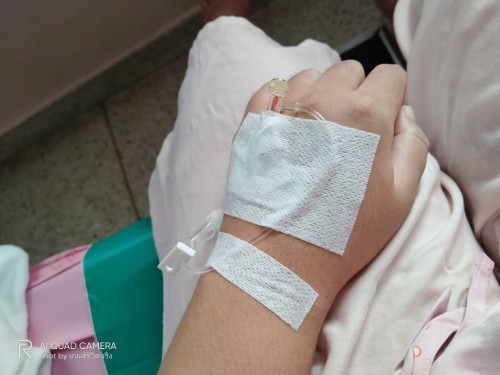 กำหนดคลอด10มกรา64 ปวดท้องตั้งตี1