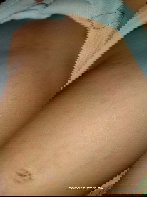 Bintik-bintik merah di perut dan wajah