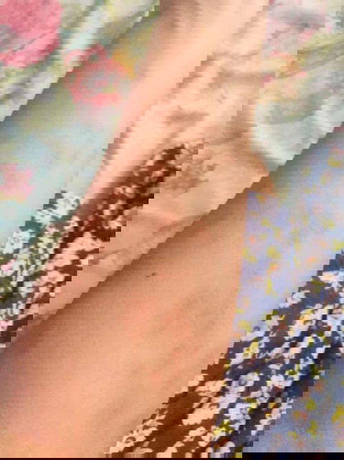 Mga moms ano kaya maganda lotion pangtangal ng darkspot dulot ng allergy na kinamot mo or stretch marks?