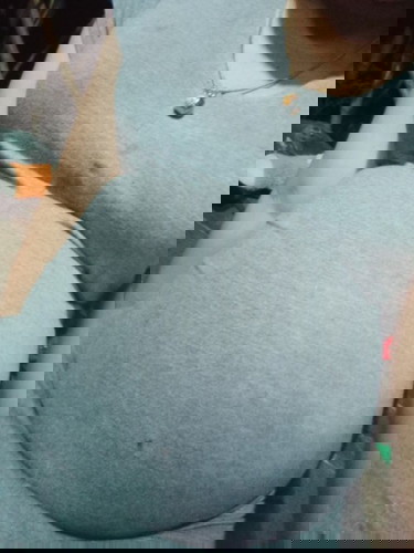 ผ่าคลอดตอน 39+4 week