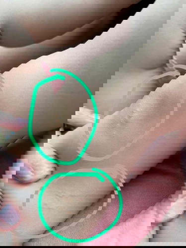 Unknown Spots on knee