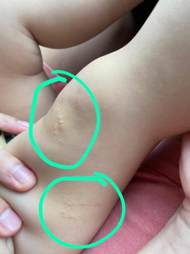 Unknown Spots on knee