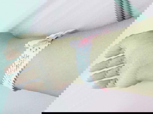 ผ่าคลอดกี่วันถึงจะเดินได้คล่องคะ ?