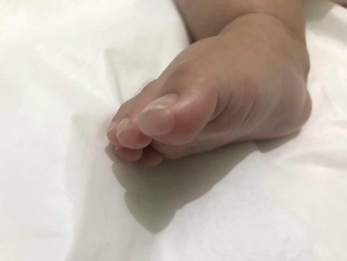 Baby's foot π