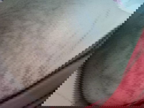 ท้องลายมีอะไรแก้ได้บ้างค๊ะ?