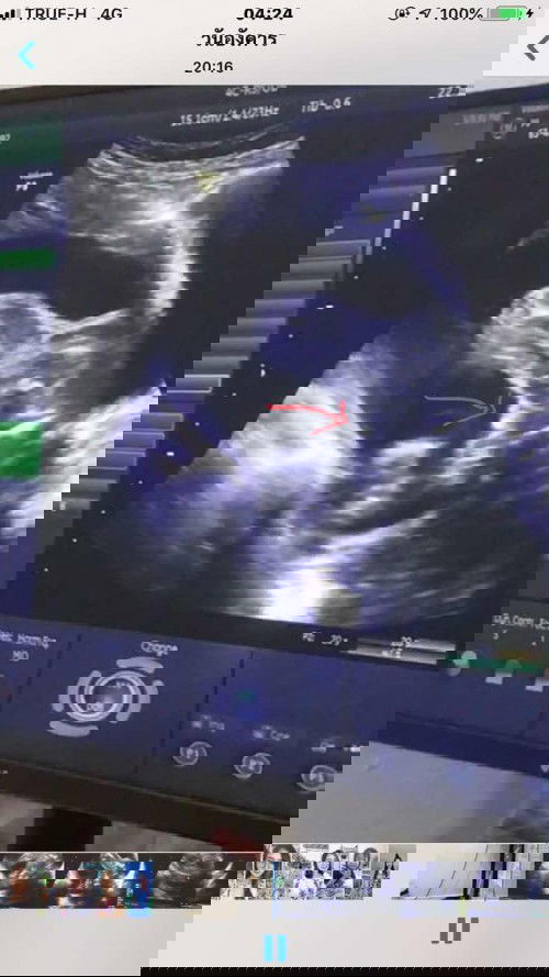 แม่ๆช่วยดูให้หน่อยค่ะ