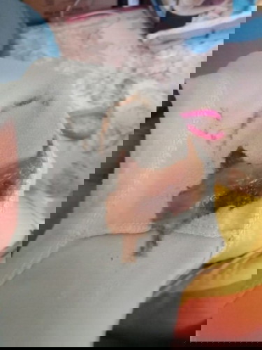 ??????????