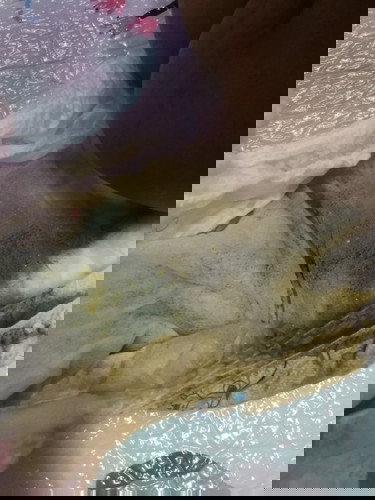 BABY POOP (diarrhea or not)