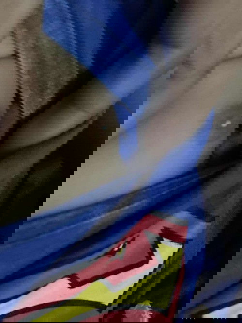 หัวนมลูกเป็นสีขาวขุ้นแบบนี้เป็นอะไรคะ