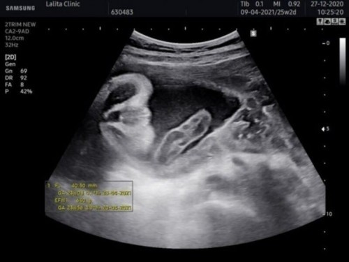 ภาพนี้คือส่วนไหนของเด็กคะ สอบถามคะ