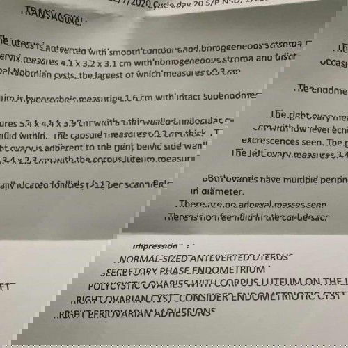 ENDOMETRIOMA RIGHT OVARY. PCOS ON THE LEFT WITH CORPUS LETEUM.