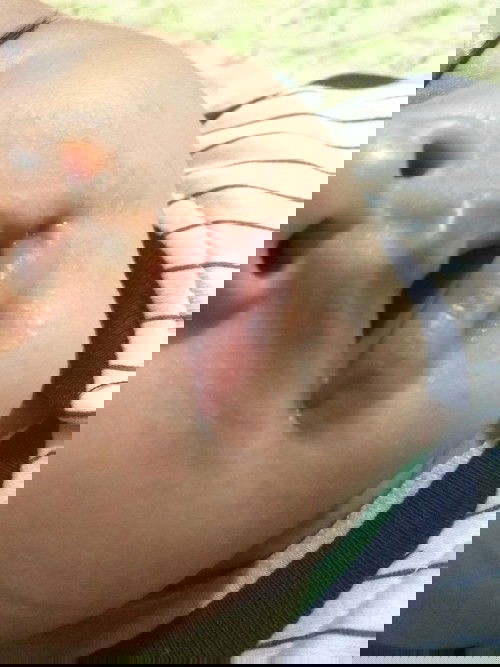 Ada bintik merah sekeliling mulut