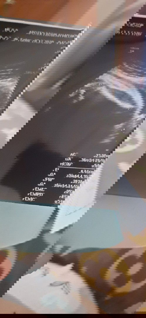 Bingung ada yang bisa bantu jawab?