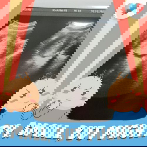 Bawah dinding rahim terdapat keputihan