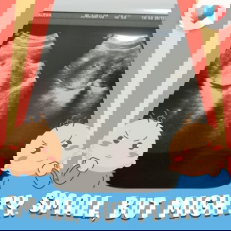 Bawah dinding rahim terdapat keputihan