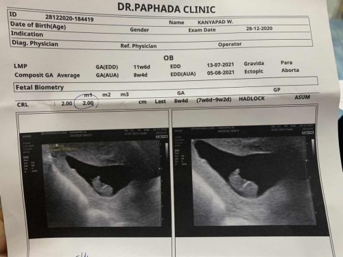 ลูกไม่อยู่แล้วหัวใจเค้าหยุดเต้นตอน 8 สัปดาห์ และแม่ไปหาหมอตามนัด 11 สัปดาห์ 6 วัน