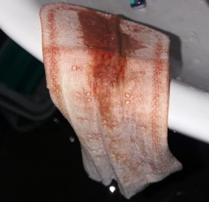 Discharge at 39weeks and 2days