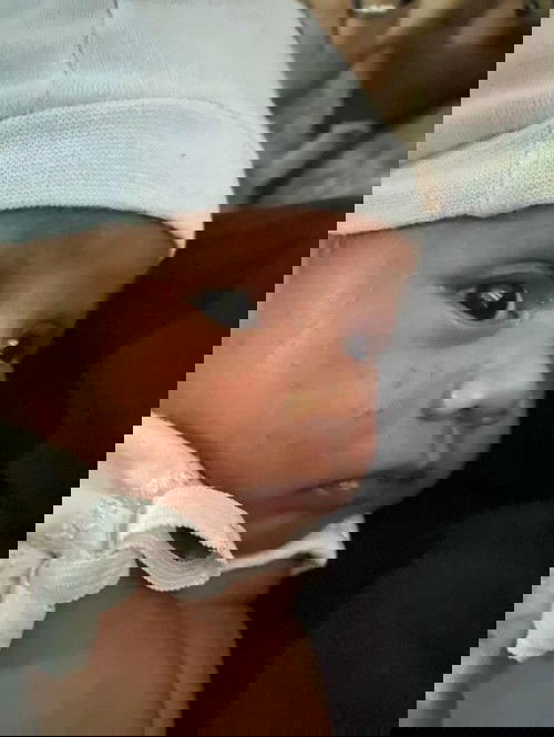 Ointment for baby for 3weeks