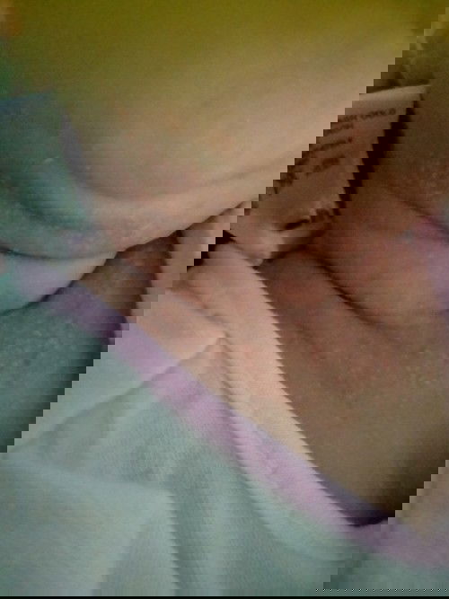 Mấy mom cho e hỏi con e mới sih đc 1tuan tuổi mà bị nổi thế này thì làm thế nào cho hết ạ