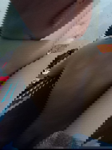 Kulit putih² di punggung