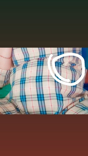 เจ็บจี้ดๆตรง