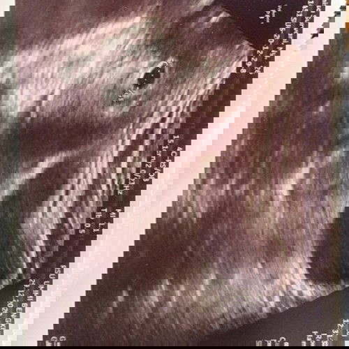 Usia sesuai hpt berbeda dgn hasil usg