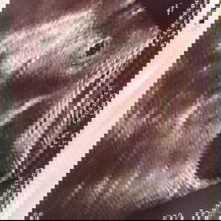 Usia sesuai hpt berbeda dgn hasil usg