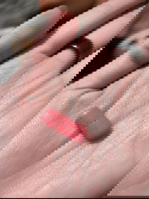 Vitamin nya ko berjamur? Atau apa ya?