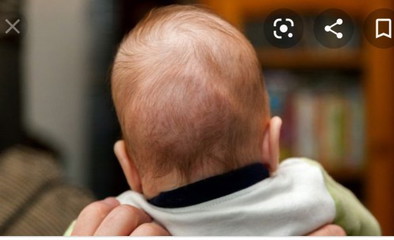 Belakang kepala bayi
