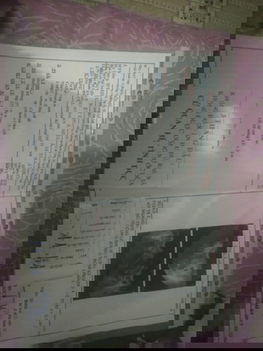 E đi siêu âm ve có kq như vậy dc ko mom tại vì e thấy ghi u lac nội mạc tử cung btrung phai