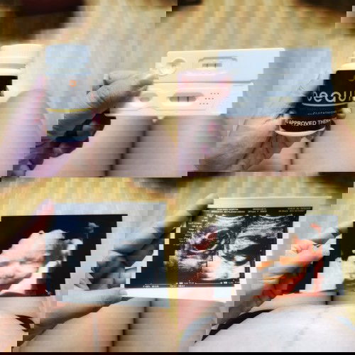 PCOS Baby 👶❤️