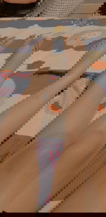 บวมไปมั้ยค่ะไม่เคยบวมพึ่งมาบวมค่ะตอนนี้ 37+6วีค