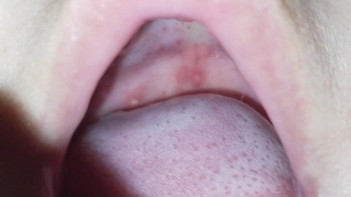 Singaw po ba to? Ano po pede igamot