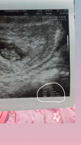 ขอสอบถามค่ะ แม่คนไหนดูอัตราซาวเป็นค่ะ 8สัปดาห์ 2วัน +5วัน คืออะไรค่ะ