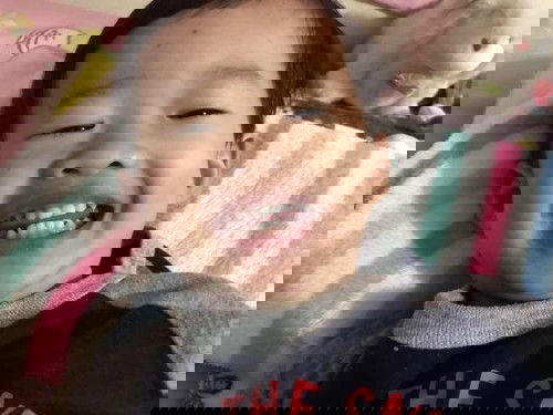 เคลือบฟลูออไรด์