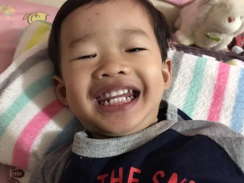 เคลือบฟลูออไรด์
